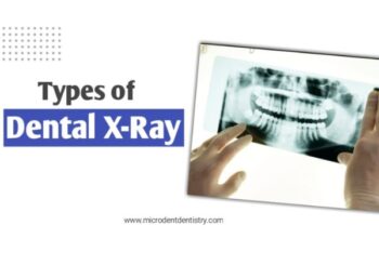 dental xray type