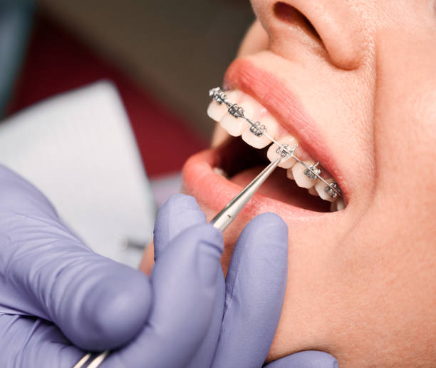 Orthodontist Treatment in Kothrud Pune
