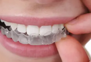 clear aligners in Pune