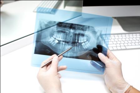 Teeth Xray Services in Pune