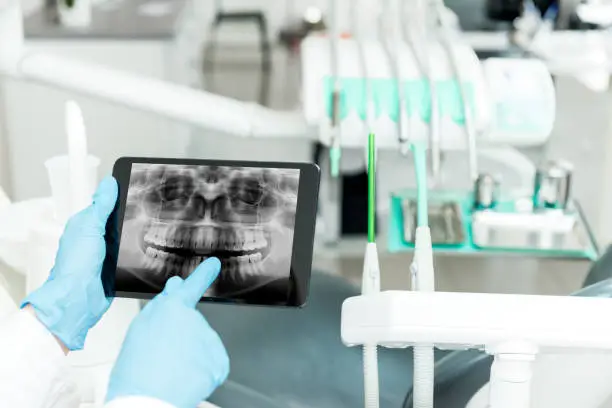 Intraoral Periapical Radiograph