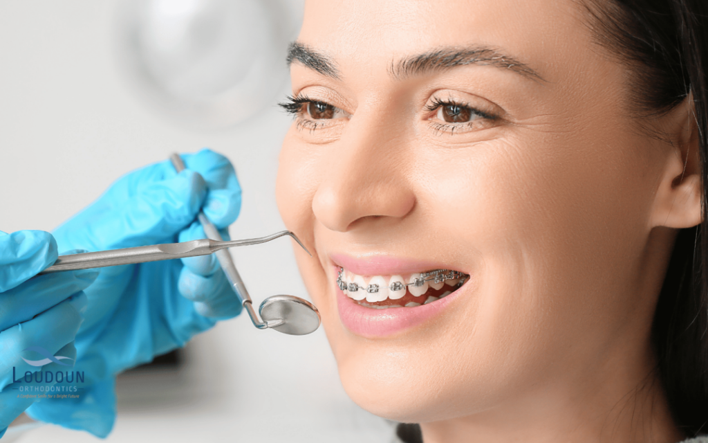 Braces Treatment in Pune