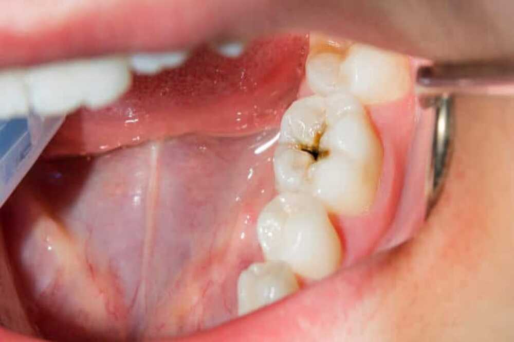 Dentist In Bavdhan