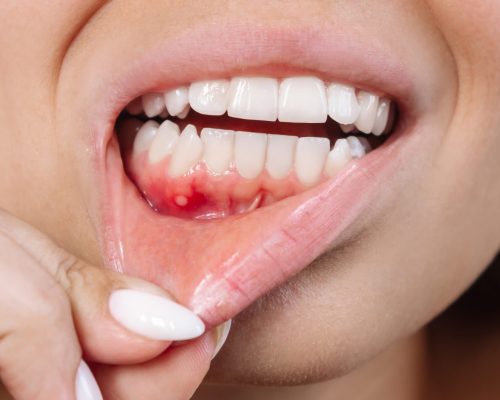 Periodontist In Pune