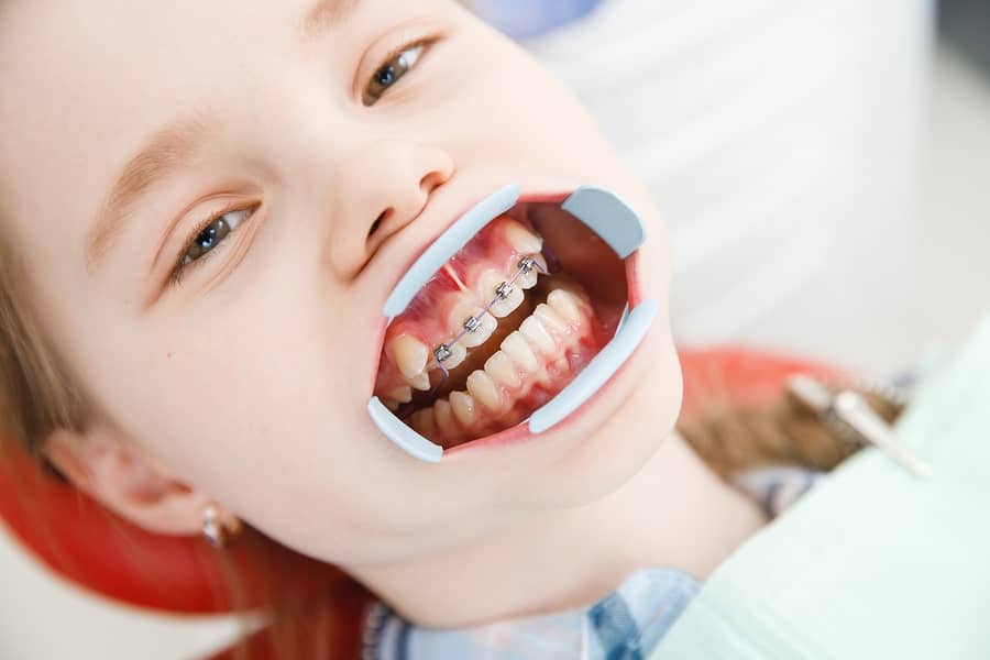 Top Orthodontist In Pune