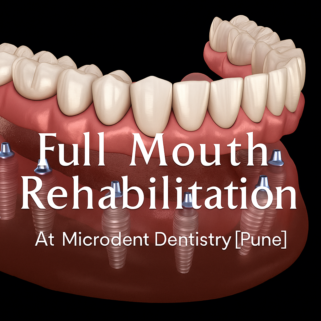 Full Mouth Rehabilitation