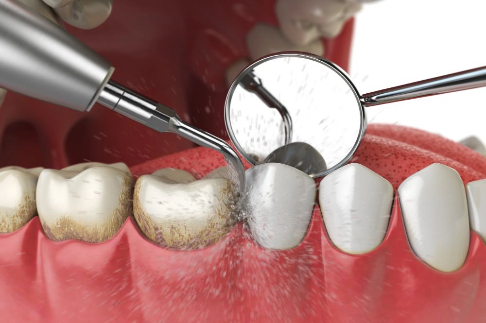 Teeth Cleaning Near Me