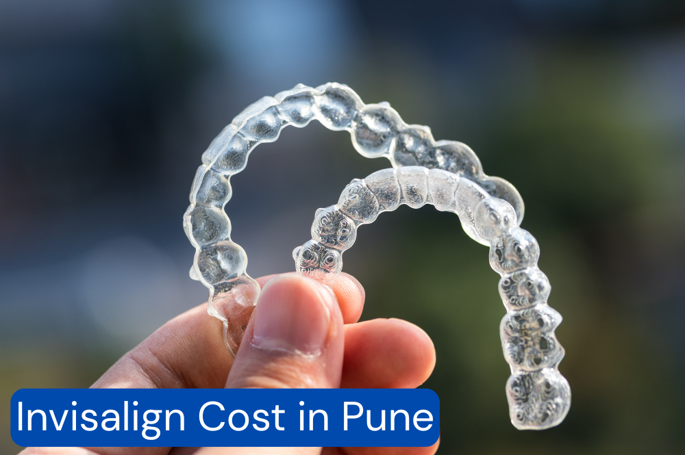 Invisalign Cost In Pune