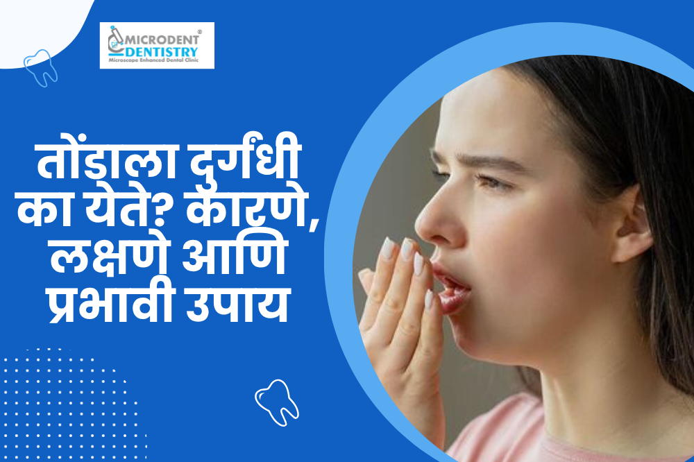 Halitosis