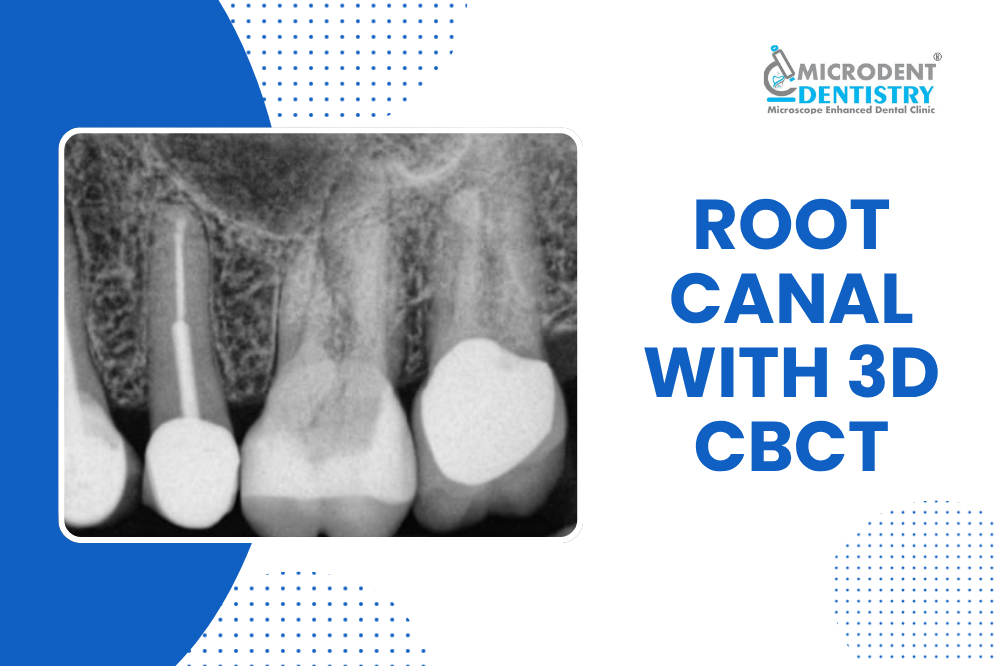 3D CBCT