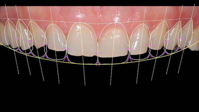 Digital Smile Design